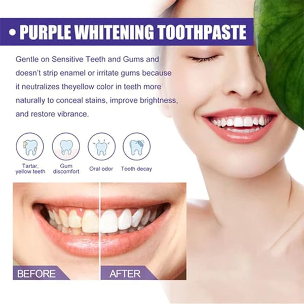 Purple Whitening Toothpaste | Color Corrector for Yellow Teeth | Brightens, Whitens & Removes Stains | Easy-to-Use Tooth Color Corrector for a Confident Smile